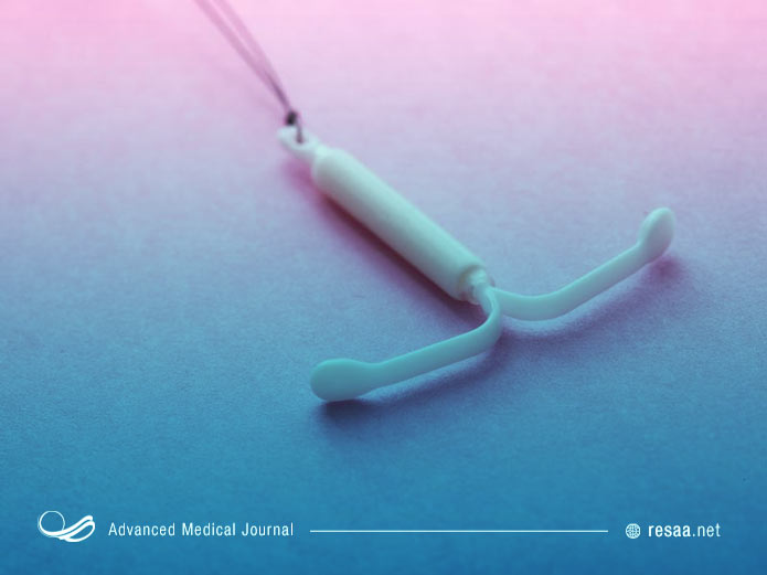 دستگاه ای یو دی برای جلوگیری از بارداری استفاده میشود