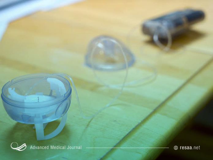 حلقه های واژینال از بارداری جلوگیری میکند