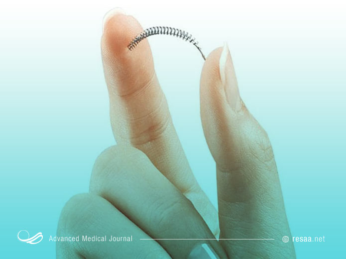 روش هایی هم برای جلوگیری دائمی از بارداری وجود دارد.