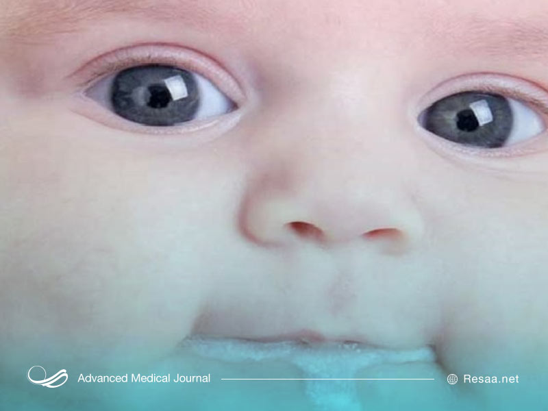 رفلاکس بازگشت محتویات معده به حلق است.