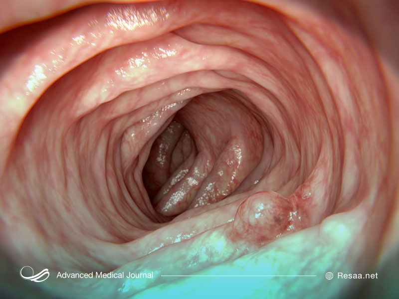 تصویری از روده