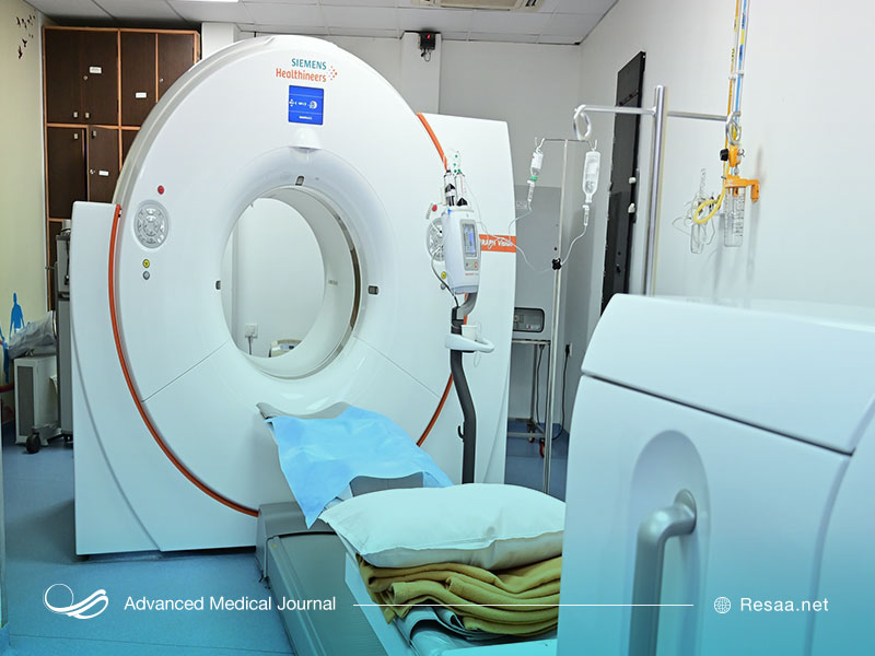 PTEدر سرطان روده