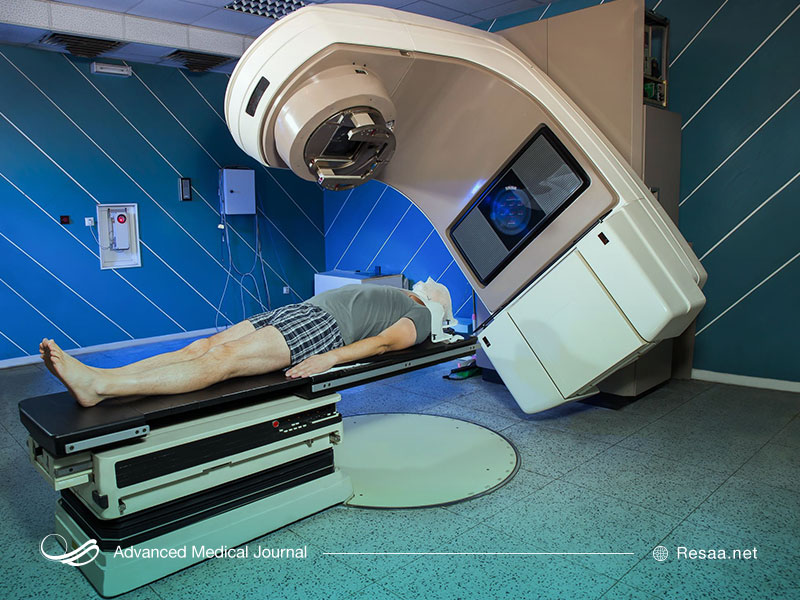 پرتودرمانی برای درمان سرطان روده