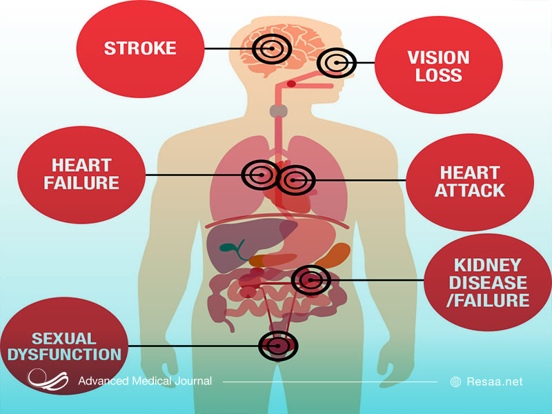 فشار خون بالا عوارض متعددی برای فرد دارد