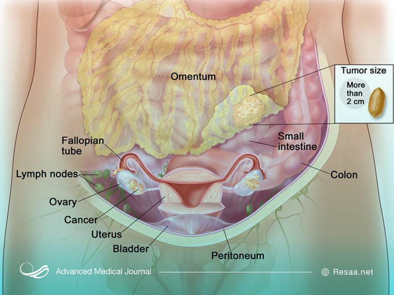 تاثیر عوامل ژنتیکی