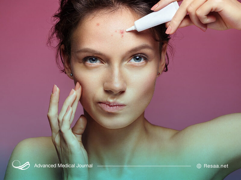 مصرف برخی داروها برای درمان آکنه با عوارض همراه است.