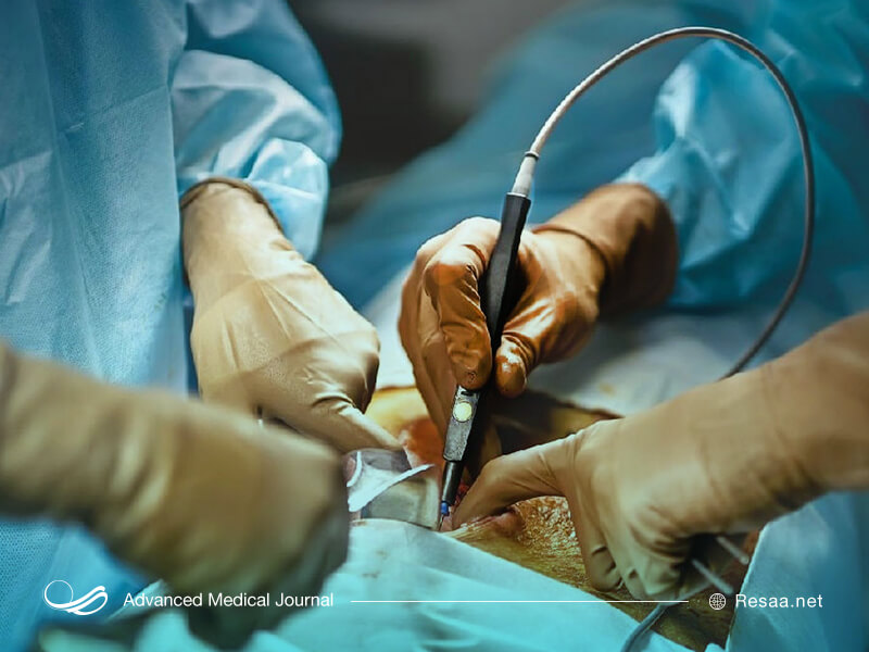 ممکن است برای درمان شقاق نیاز به جراحی باشد.