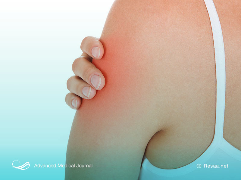 درد بازو ممکن است به شکل سوزن سوزن یا حس گر گرفتگی در دست ظاهر شود.