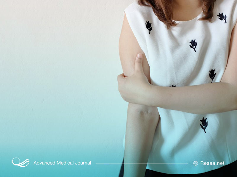 برای تشخیص منبع درد بازو ممکن است نیاز به MRI داشته باشید.