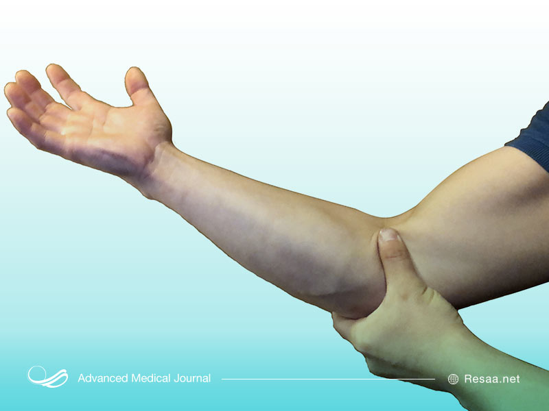 همراه با درد بازو ممکن است سفت شدن عضلات را نیز تجربه کنید.