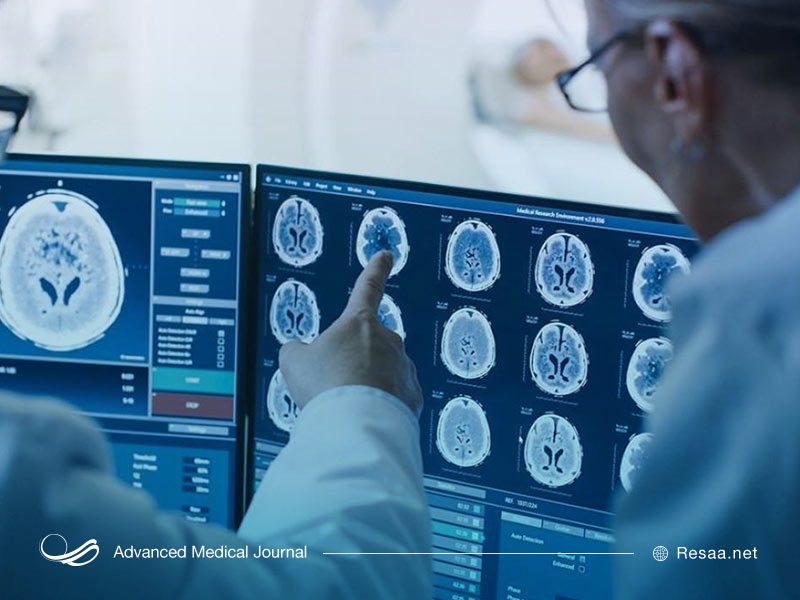 علائم سرطان و تومور مغزی