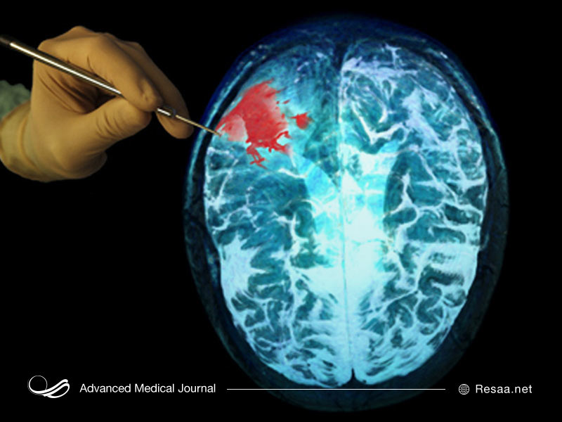 نقش مغز در بدن انسان چیست