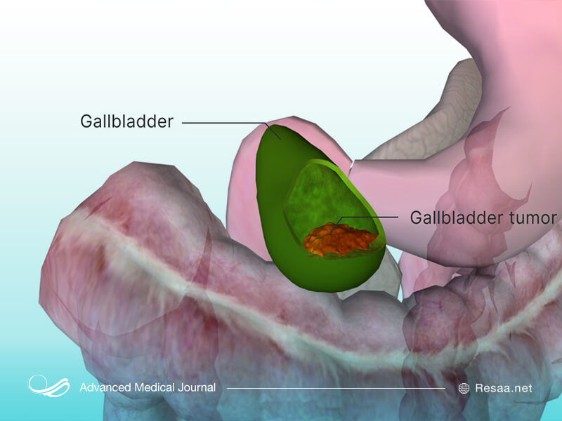 محل قرارگیری کیسه صفرا