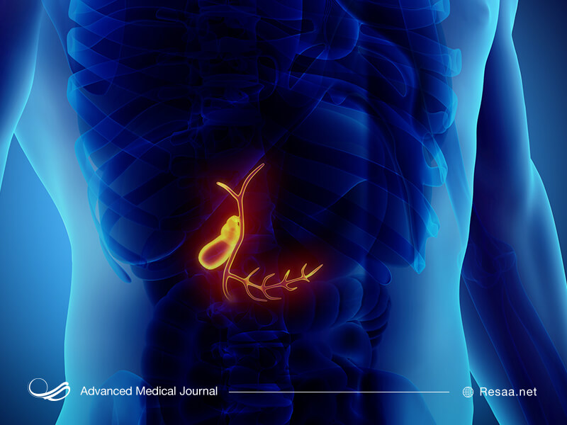 سرطان کیسه صفرا زنان را بیشتر درگیر می‌کند.