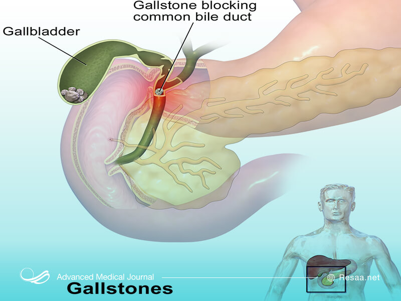 پزشک به منظور تشخیص بیماری معاینه بدنی انجام می‌دهد.