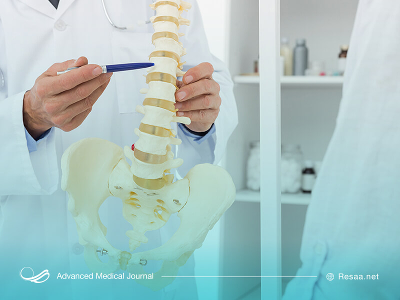 خم شدگی ستون فقرات یا کیفوز میتواند به دلایل متفاوتی ایجاد شود.