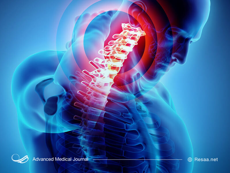 یکی از اثرات کیفوز کمردرد دائمی میباشد.