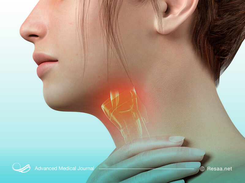 سرطان حنجره چیست و چطور بوجود میاید