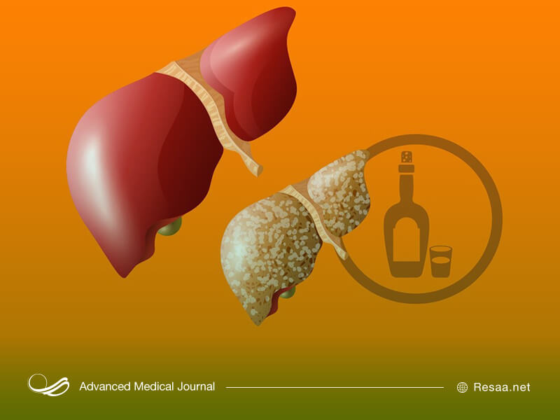 مصرف الکل و مواد غذایی ناسالم سبب تحریک کبد می شوند