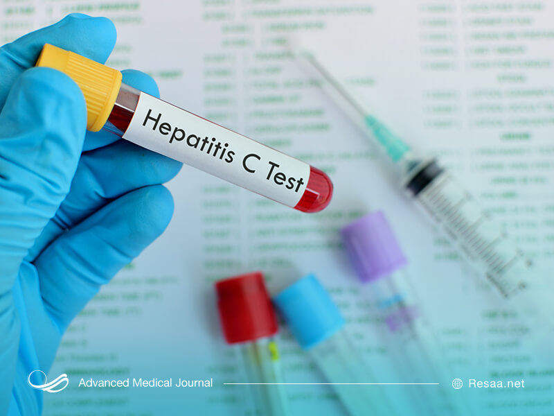 برای تشخیص بیماری هپاتیت باید آزمایش خون انجام شود.