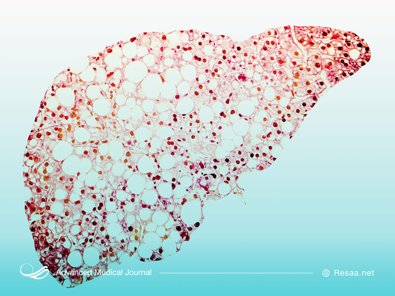 با شناخت ساختار کبد بیماریهایی که میتواند کبد را درگیر کند نیز خواهیم شناخت