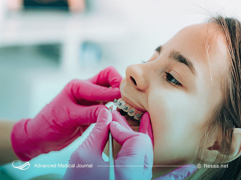 روش های مختلف ارتودنسی