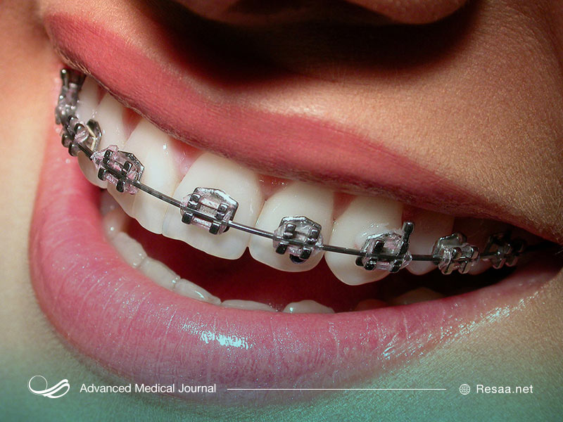 ارتودنسی و لبخندی زیباتر