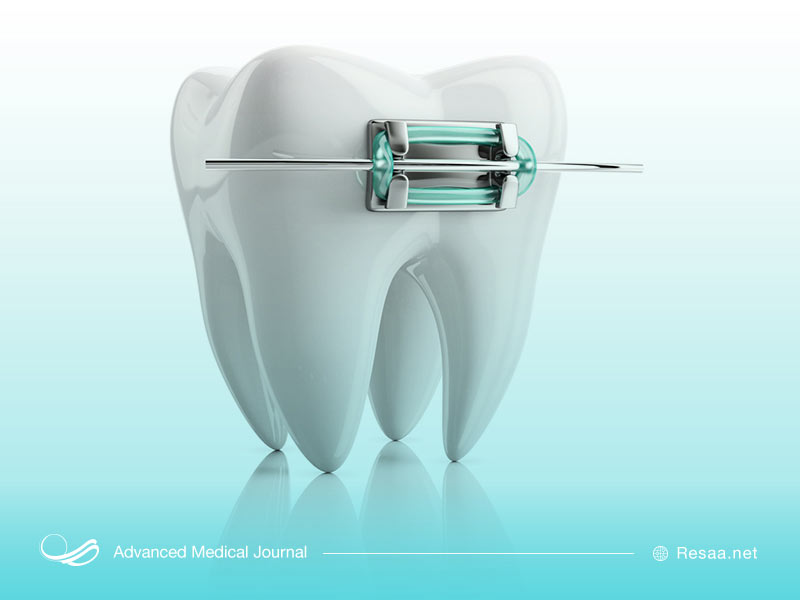 ارتودنسی دندان ها