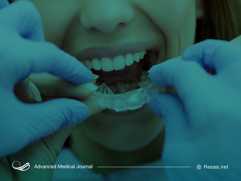 انواع مختلف براکت های ارتودنسی