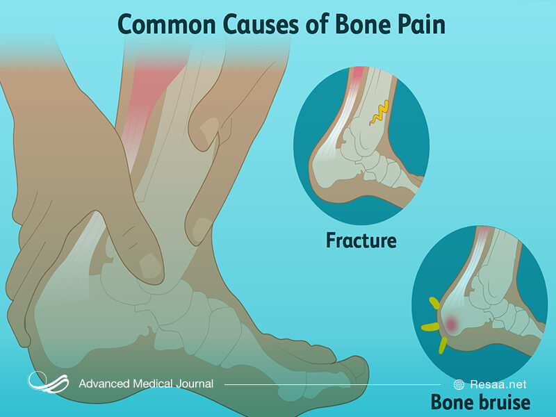 نشانه های بروز بیماری پاژه
