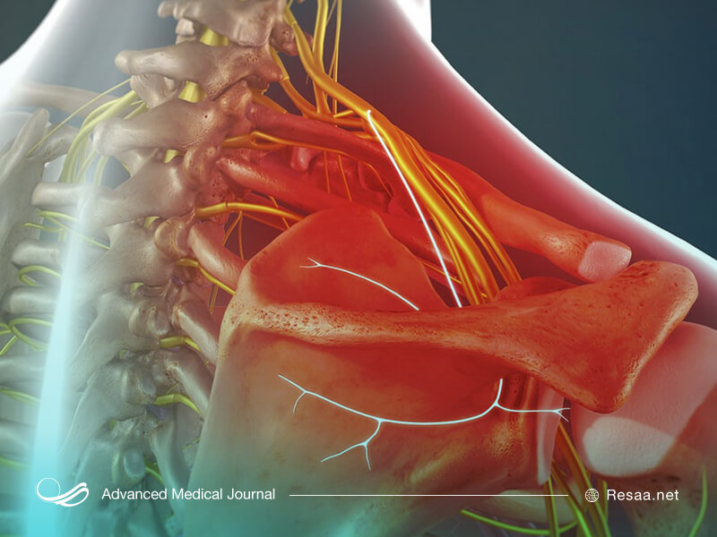 درد در شانه