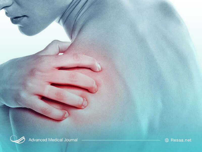 تاندونیت شانه