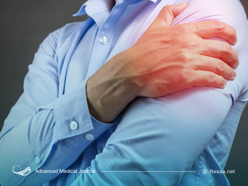 التهاب شانه ها