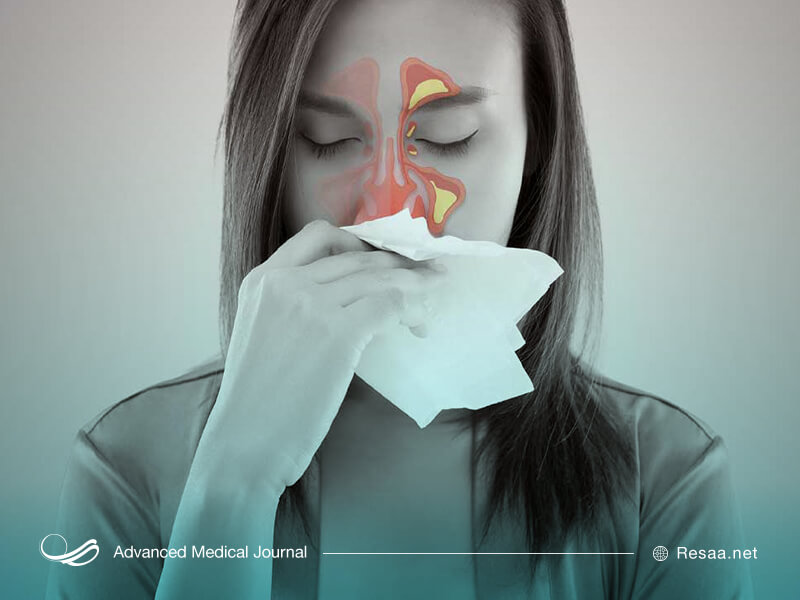 سینوزیت در اثر تورم بافت سینوس ها اتفاق می‌افتد.