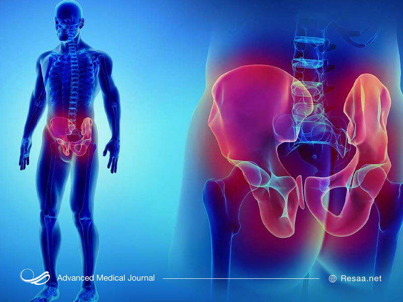 درمان شکستگی لگن