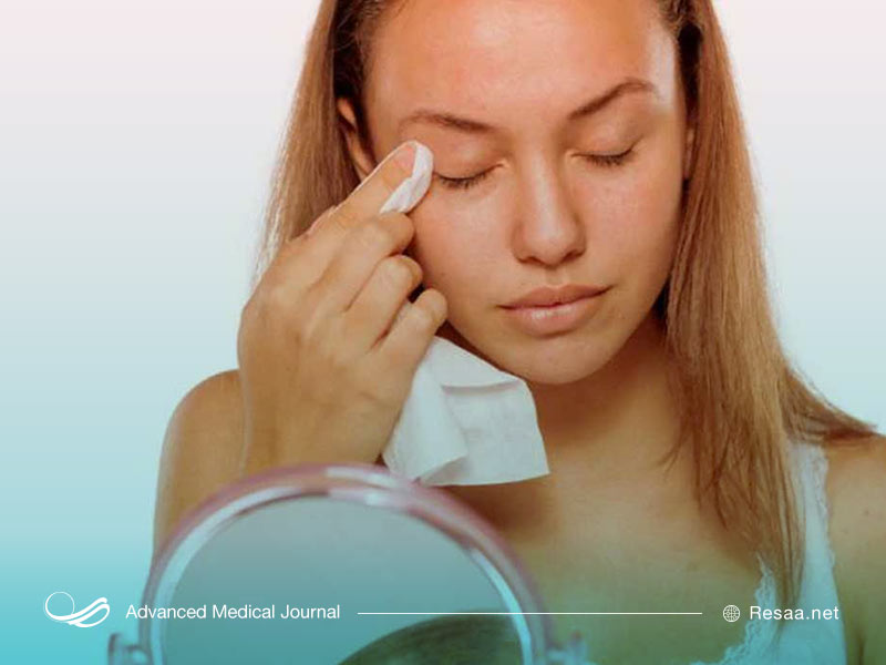 راههای درمان گل مژه