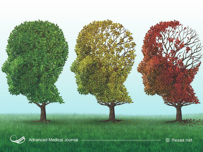 نشانه های بروز آلزایمر