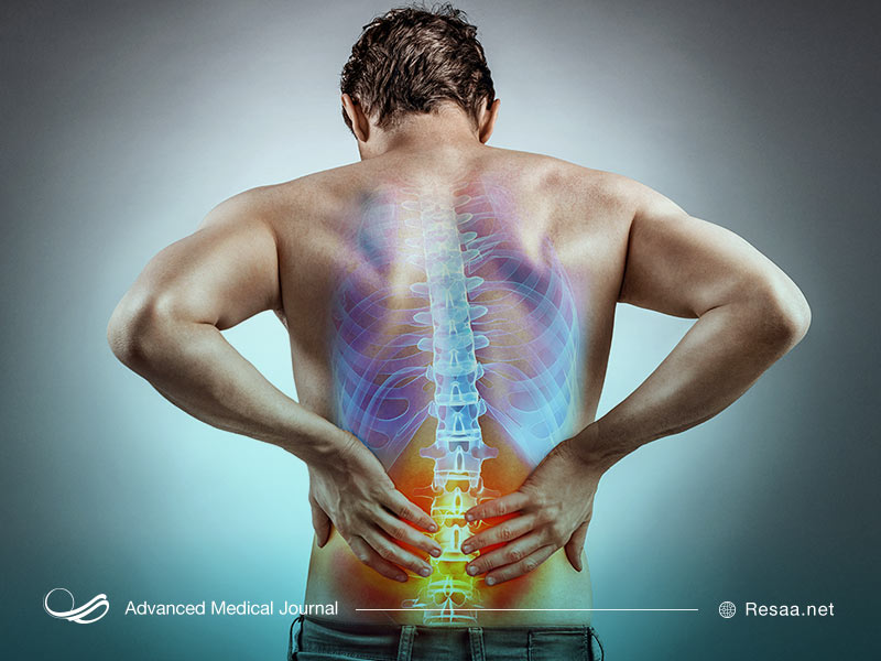 کمر درد حاد