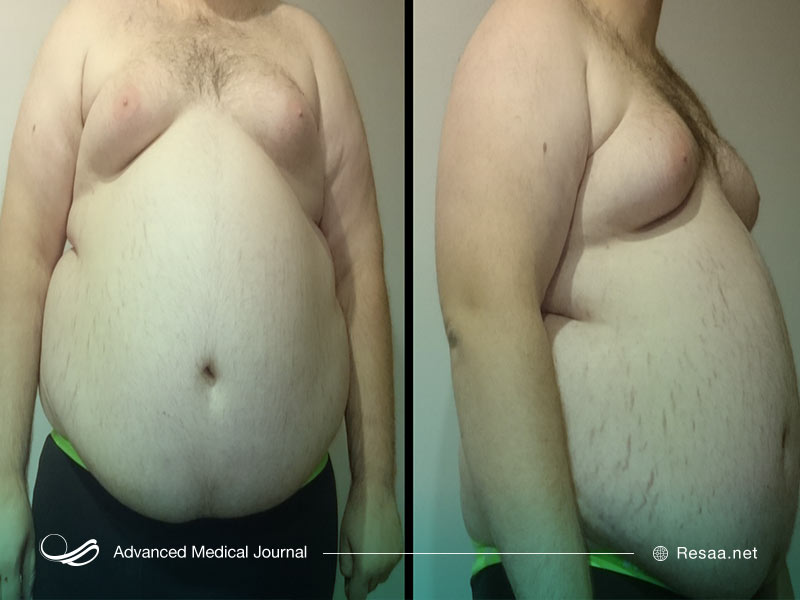 محدود کردن مصرف الکل