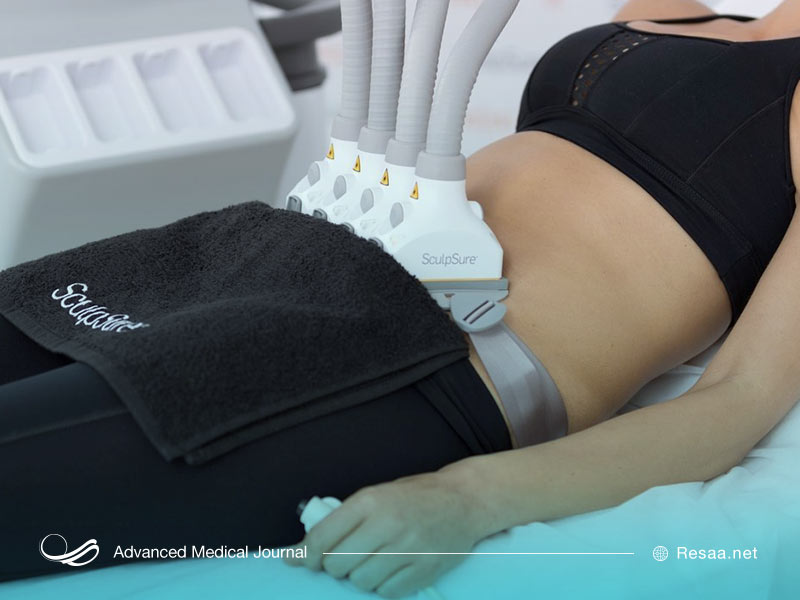 جراحی برای کاهش چربی های شکمی