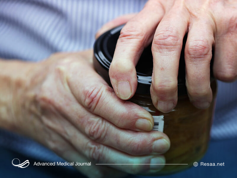 علایم و نشانه های بیماری تونل کارپال
