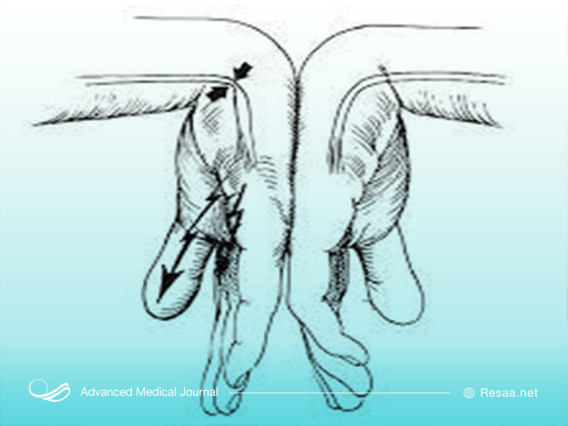 آزمایش فالن