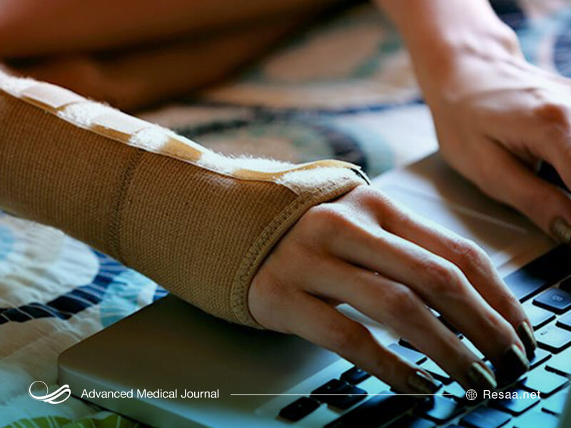 مچ بند طبی برای درمان سندروم تونل کارپال