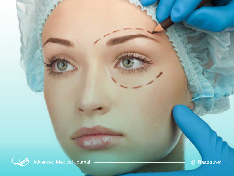 عمل زیبایی جراحی پلک