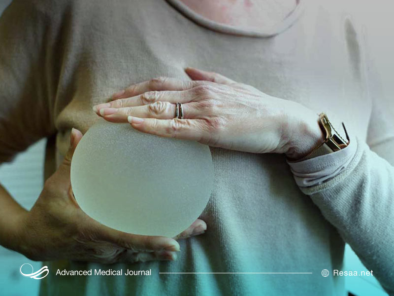 جراحی زیبایی سینه ها