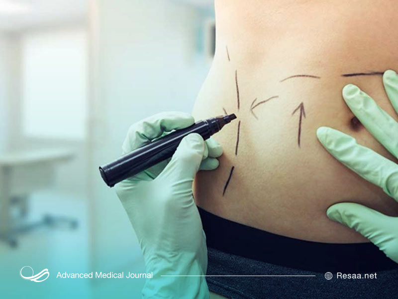 روشهای غیر جراحی زیبایی