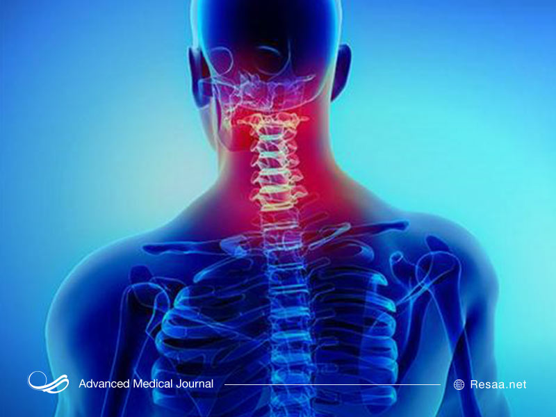 فتق دیسک چگونه ایجاد میشود