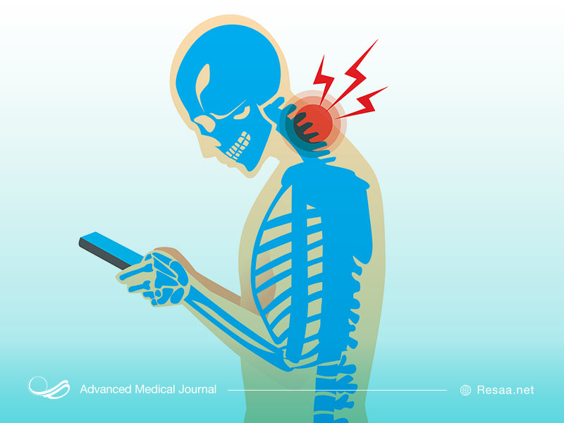 تحرک گردن به آرامی میتواند از ابتلا به دیسک گردن جلوگیری کند