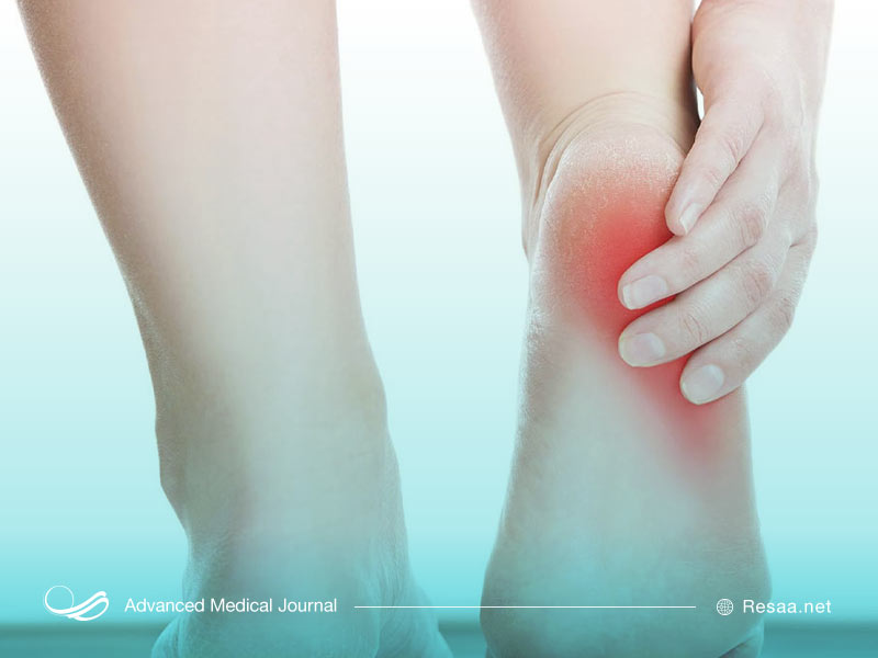 درد پاشنه پا میتواند با استفاده از کفیهای مناسب درمان شود.