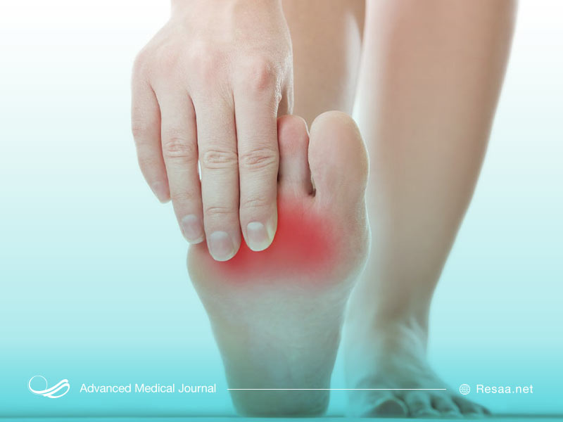 درد پنجه پا در اثر ضعف ماهیچههای پا ایجاد میشود.